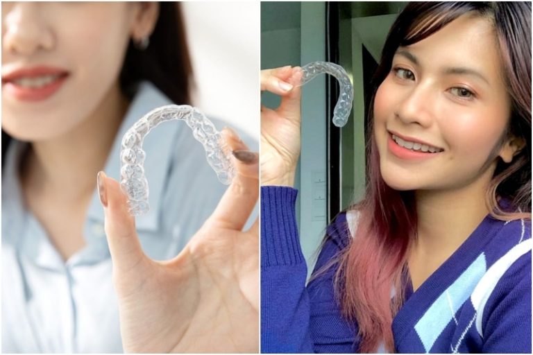 Considering braces? Try Zenyum Invisible Braces and enjoy 200 off