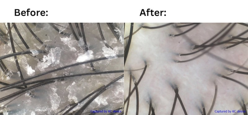 Beijing 101 Scalp Revival Treatment